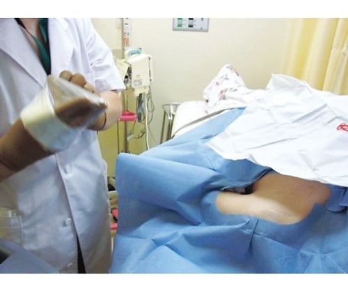 Echo probe cover II (for body openings and intraoperative use) 1500mm 1 box (24 sets) P09150 1 box (24 sets)