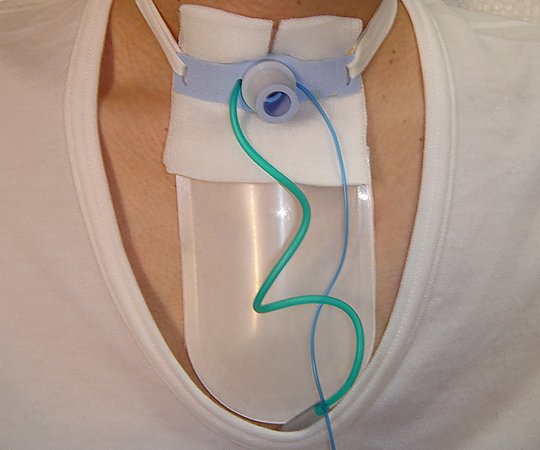 痰受けポケット（気管切開者用・すぱっと）1箱（30個入） 1箱(30個入)