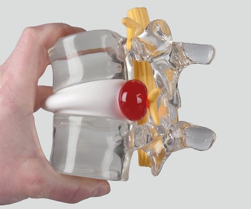 ヘルニアモデル 190×160×140　4400 1個