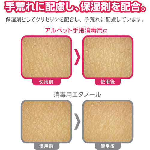 Saraya Alpet Hand Sanitizer Alpha 5L 41238 1 bottle