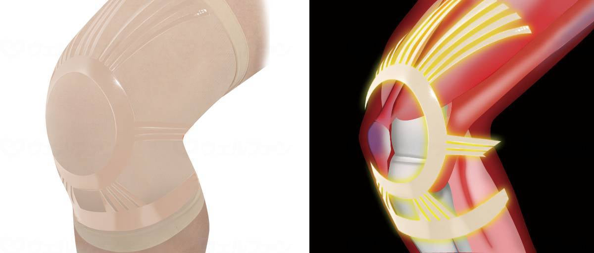 Plandu 무릎 극 등