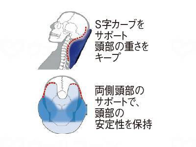 아이소넥스 USAKO 크비마크라