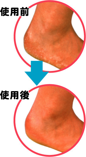 Heel Smooth Supporter Beige Free Size 1 pc