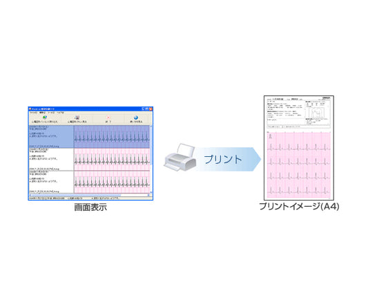 Electrocardiogram Printing Software HCG-SOFT-2 1 piece