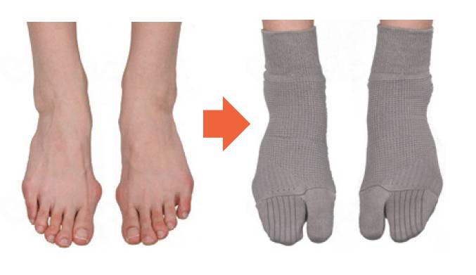 Corporation Pearl Star Bunion Socks, Gray, 26-27cm