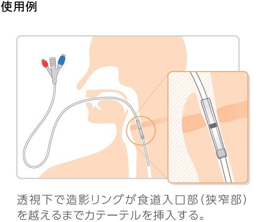 食道拡張用バルーンカテーテル 14Fr 2本入　8000015366 1箱(2本入)