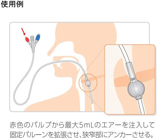 食道拡張用バルーンカテーテル 14Fr 2本入　8000015366 1箱(2本入)