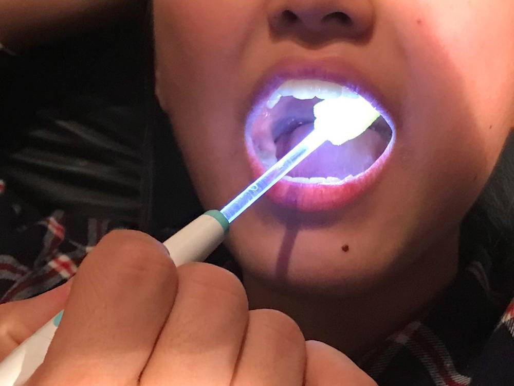 Betel Pika Spot Glowing Toothbrush