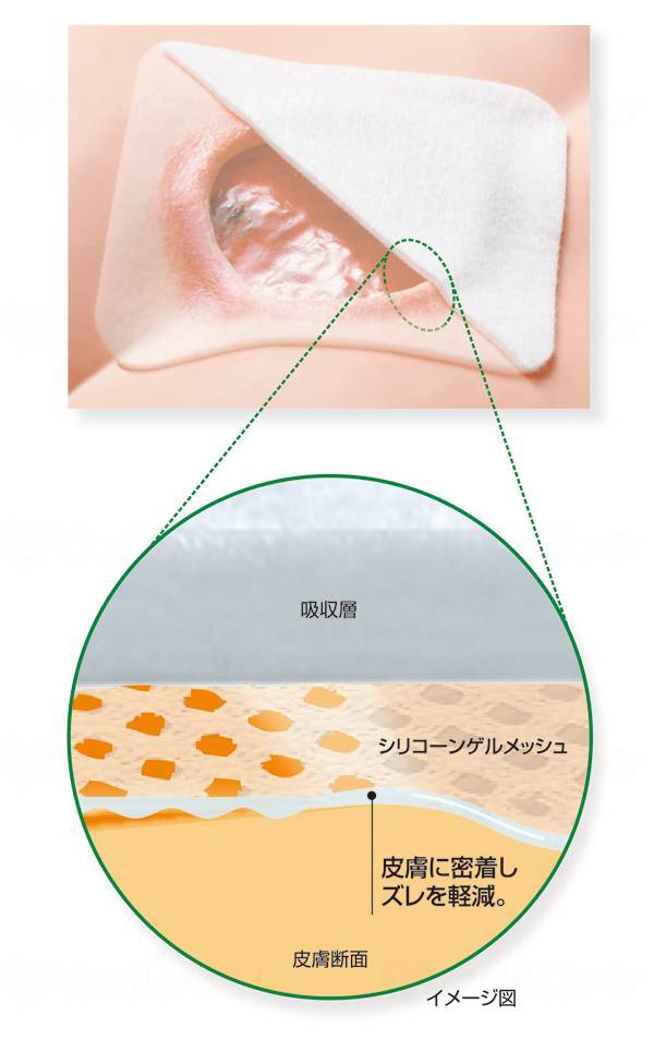 Alcare SI Aid (3 sheets) No. 7 (3 sheets)