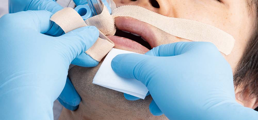 アルケアｽﾑｰｽﾞﾘﾑｰﾊﾞｰ/ﾜｲﾌﾟｼｰﾄ（20枚入り） 20枚入